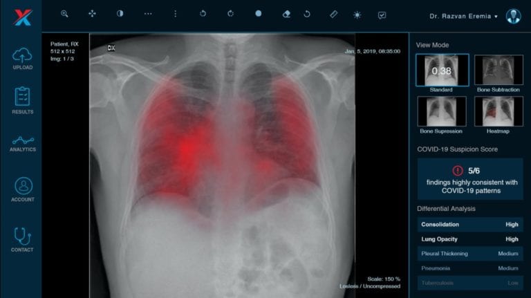 XVision: scanăm, cu inteligenţa artificială, pacienții suspecți de COVID-19, în laboratoare mobile