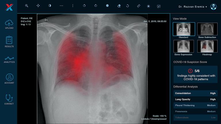 Un startup medical fondat de 4 studenți români obține 1 milion Euro finanțare